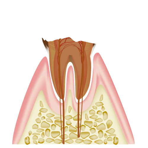 real-teeth005.png