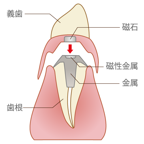 false-tooth012.png