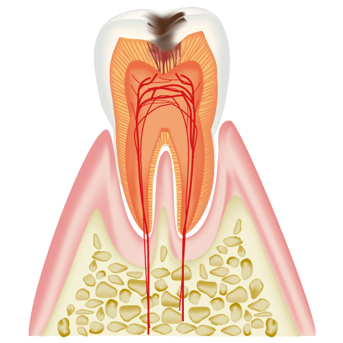 real-teeth003.png