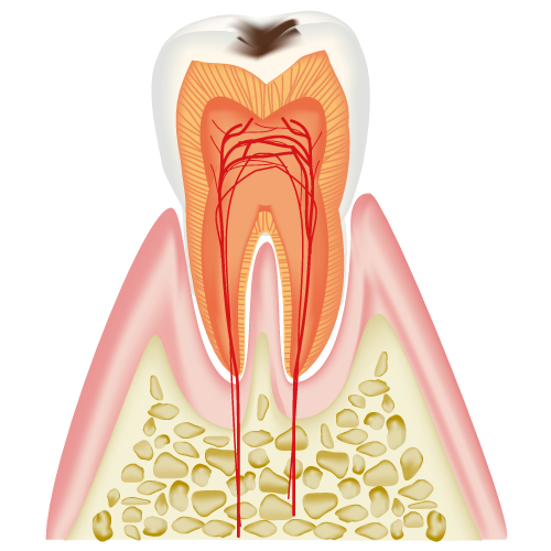 real-teeth002.png