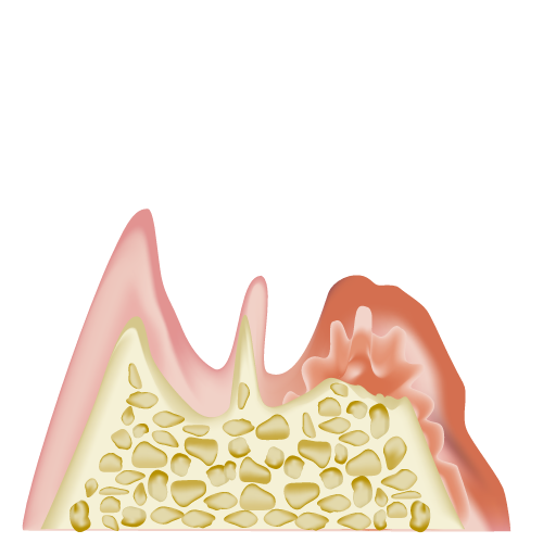 real-teeth008.png