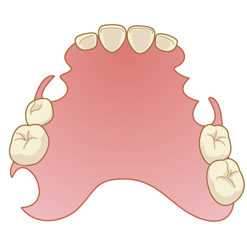 false-tooth009.png